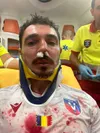 Accidentarea lui Dragoș Huiban. Foto: GOLAZO.ro