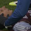 Lucas Digne, accidentare în Everton - Aston Villa (5).jpg