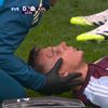 Lucas Digne, accidentare în Everton - Aston Villa (6).jpg