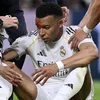 Kylian Mbappe, umplut de sânge în meciul Real Madrid - Girona FOTO Imago