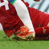 Entorsa de gleznă suferită la 2-0 cu Serbia, în grupele CM 2018