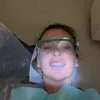 CoCo Vandeweghe a suferit leziuni la față, după ce a căzut la Wimbledon (FOTO: Instagram @cocovandey)