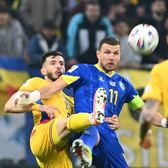 Ca după un meci de box!   Edin Dzeko  s-a întors de la București având pe față urmele loviturii lui Mihai Popescu