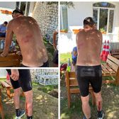 Atacat de 8 câini pe un traseu turistic!   Un antrenor de atletism s-a luptat 20 de minute cu fiarele: „M-au târât la pământ,   m-am temut pentru viața mea”