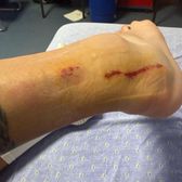 „Putea să-i rupă piciorul”  Cum arată glezna lui Gheorghiță  la 24 de ore după    Petrolul - FCSB