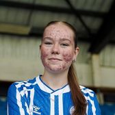 Adolescentă atacată pentru cum arată     Fotbalista de doar 16 ani  a fost apărată de mai multe personalități, după ce a fost luată la țintă online