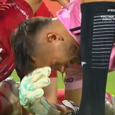 Dur-Bozoancă va fi operat    FOTO.  Diagnosticul crunt primit de portarul de la Oțelul, după ce a   fost lovit în față  de un coechipier în meciul cu FC Argeș