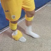 Probleme pentru FCSB  Campioanei României i s-a accidentat unul dintre   jucătorii de bază:  „Îl doare când merge”