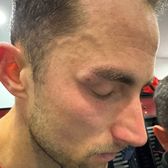 Are dreptate Ilyeș?    FOTO:  Cum arată Eppel după   lovitura încasată  de la Boateng: „Nu poți să nu chemi la VAR”