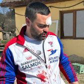 „Dinții sunt «praștie»”    Antrenorul bătut de fani după meci   a refăcut,  pentru GOLAZO.ro, filmul oribilului incident