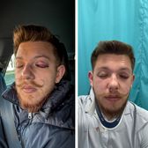 Bătaie la Sf. Gheorghe  Doi oficiali ai clubului   Sepsi,  implicați într-o altercație violentă, cu conotații politice: „Din cauza alegerilor din Ungaria”