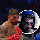 Ilia Topuria, desfigurat la Casa Albă!    FOTO:  Primul eșec pentru   unul dintre cei mai temuți luptători.  Americanul Justin Gaethje l-a năucit și l-a obligat să abandoneze!
