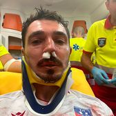 Momente horror după meci   FOTO.   Dragoș Huiban,  plin de sânge după un fault în ultimele minute: „Nici cartonaș nu a dat”