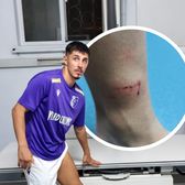 „Se arbitrează în funcție de interese”   FOTO.  Scandal după victoria lui Sepsi!  Borța a ajuns la spital  după intrarea de la faza golului
