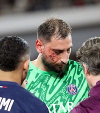 Donnarumma, desfigurat Portarul italian a fost  „capsat” pe viu  de medicii lui PSG