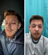 Bătaie la Sf. Gheorghe  Doi oficiali ai clubului   Sepsi,  implicați într-o altercație violentă, cu conotații politice: „Din cauza alegerilor din Ungaria”