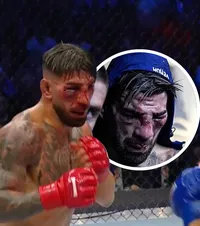 Ilia Topuria, desfigurat la Casa Albă!    FOTO:  Primul eșec pentru   unul dintre cei mai temuți luptători.  Americanul Justin Gaethje l-a năucit și l-a obligat să abandoneze!