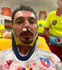 Momente horror după meci   FOTO.   Dragoș Huiban,  plin de sânge după un fault în ultimele minute: „Nici cartonaș nu a dat”