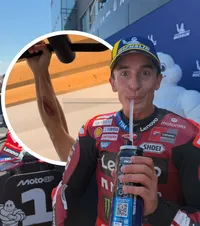 Marquez, poză tulburătoare   FOTO:  Campionul mondial din MotoGP  și-a șocat fanii cu imaginea pe care a publicat-o