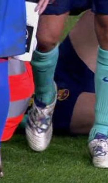 ​VIDEO Messi, accidentare teribila dupa o intrare violenta a lui Ujfalusi  