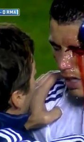 VIDEO Cristiano Ronaldo, accidentare teribila: A fost schimbat la pauza pentru ca nu mai vedea bine