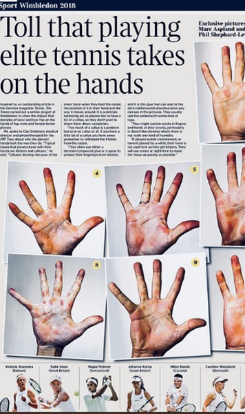 Sacrificiul din spatele frumuseții tenisului - Cum arată mâinile Simonei Halep și ale altor jucători din circuitul profesionist