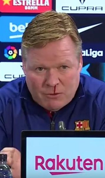 VIDEO Antrenorul Barcelonei a început să sângereze în timpul unei conferințe de presă - Explicația incidentului suferit de Ronald Koeman