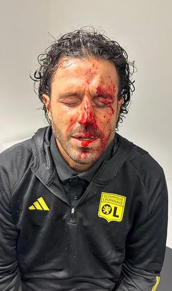 FOTO Prima pagină șocantă a cotidianului L'Equipe după incidentele de dinaintea partidei Marseille vs Lyon