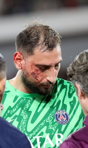 Donnarumma, desfigurat Portarul italian a fost  „capsat” pe viu  de medicii lui PSG