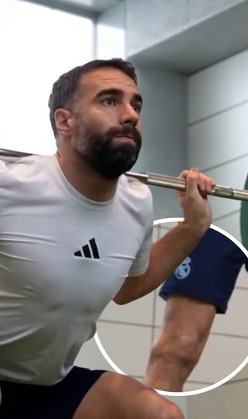 Carvajal, ce diferenţă!  Fundaşul de la  Real Madrid  continuă recuperarea după accidentarea gravă  » Cum arată piciorul operat