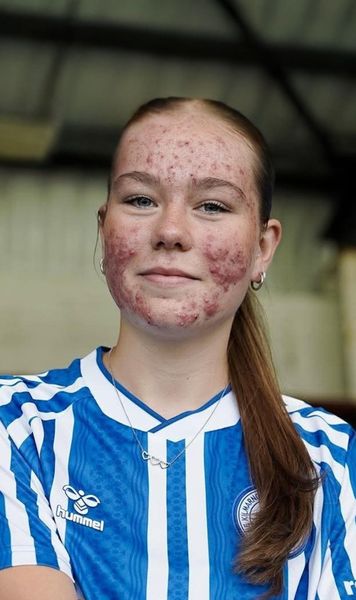 Adolescentă atacată pentru cum arată     Fotbalista de doar 16 ani  a fost apărată de mai multe personalități, după ce a fost luată la țintă online