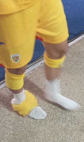 Probleme pentru FCSB  Campioanei României i s-a accidentat unul dintre   jucătorii de bază:  „Îl doare când merge”