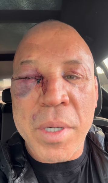 Atacat de fiul adversarului  A revenit în ring la 49 de ani și   a ajuns la spital după meci!  Legenda UFC, lăsată inconștientă de o lovitură brutală