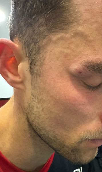 Are dreptate Ilyeș?    FOTO:  Cum arată Eppel după   lovitura încasată  de la Boateng: „Nu poți să nu chemi la VAR”