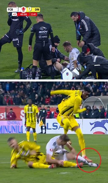 Kovtaliuk, accidentare gravă    FOTO:  Boateng a scăpat nesancționat după faultul care l-a scos din circuit pe atacantul de la Botoșani:   „Scandalos!”