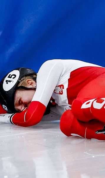 Îngrozitor!  FOTO. Accident terifiant la Jocurile Olimpice.   Patinatoare lovită la ochi cu lama.  Primele vești după operație