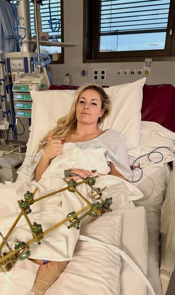 Teribila dramă a lui Lindsey Vonn  Dezvăluie că   i se putea amputa piciorul.  A publicat o poză horror!  Ce sindrom a suferit, ce fracturi, dar și cum a fost salvată