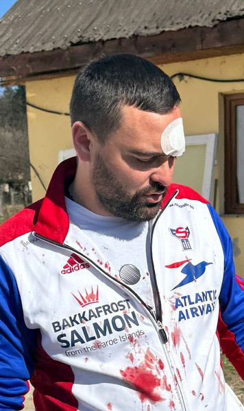 „Dinții sunt «praștie»”    Antrenorul bătut de fani după meci   a refăcut,  pentru GOLAZO.ro, filmul oribilului incident