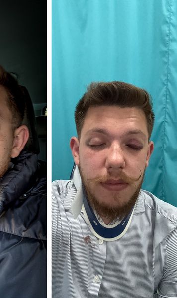 Bătaie la Sf. Gheorghe  Doi oficiali ai clubului   Sepsi,  implicați într-o altercație violentă, cu conotații politice: „Din cauza alegerilor din Ungaria”