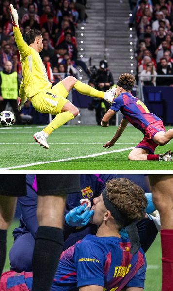 Incident horror    FOTO.  Momentul în care Fermin Lopez   este lovit cu gheata în față   în meciul Atletico - Barcelona. S-a umplut de sânge!