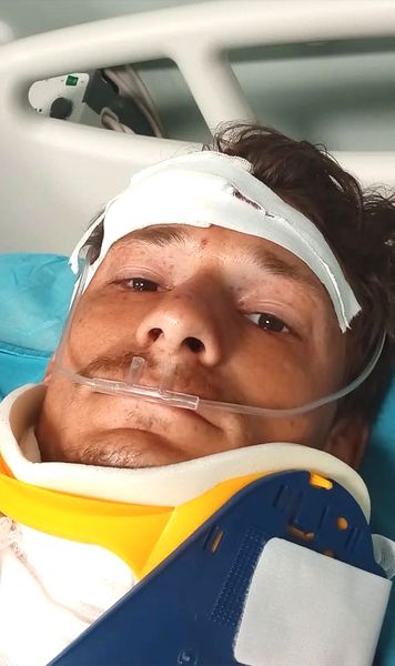„Am văzut moartea cu ochii”  Ultramaratonistul Adrian Șovea,   mesaj cutremurător  după ce a fost lovit de o mașină în timpul unei curse caritabile