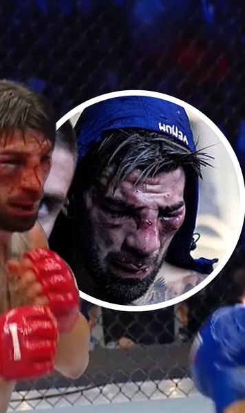 Ilia Topuria, desfigurat la Casa Albă!    FOTO:  Primul eșec pentru   unul dintre cei mai temuți luptători.  Americanul Justin Gaethje l-a năucit și l-a obligat să abandoneze!