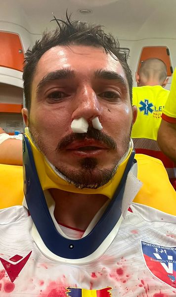Momente horror după meci   FOTO.   Dragoș Huiban,  plin de sânge după un fault în ultimele minute: „Nici cartonaș nu a dat”