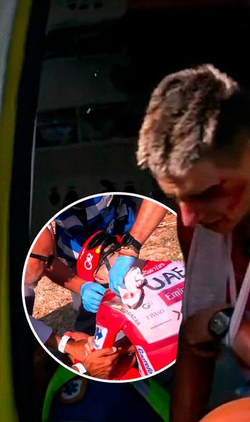 Pogacar, diagnostic crunt  Are nevoie de operație după accidentul grav din Spania.  Anunțul făcut de medici  + Prima imagine din spital