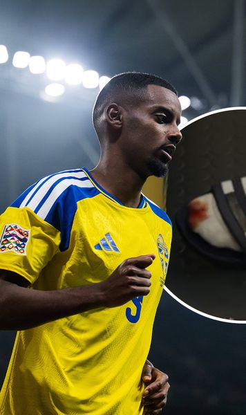 „Cicatrici de luptă”   FOTO.  Alexander Isak, cu  piciorul însângerat  după Suedia - România. Cine l-a rănit pe starul lui Liverpool