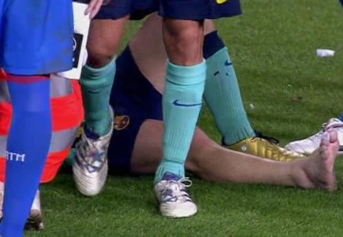 ​VIDEO Messi, accidentare teribila dupa o intrare violenta a lui Ujfalusi  