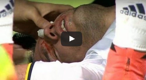 VIDEO Accidentare teribila pentru Robin van Persie - A fost la un pas sa-si piarda ochiul stang