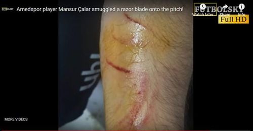 VIDEO Se întâmplă în liga a treia din Turcia: Mai mulți jucători îl acuză pe un adversar că a intrat pe teren cu o lamă și i-a tăiat