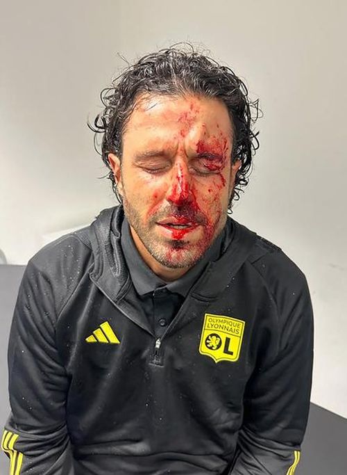 FOTO Prima pagină șocantă a cotidianului L'Equipe după incidentele de dinaintea partidei Marseille vs Lyon