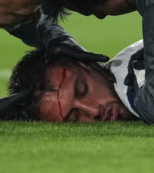 Bentancur și-a pierdut cunoștința după o ciocnire cap în cap Fotografii: Imago